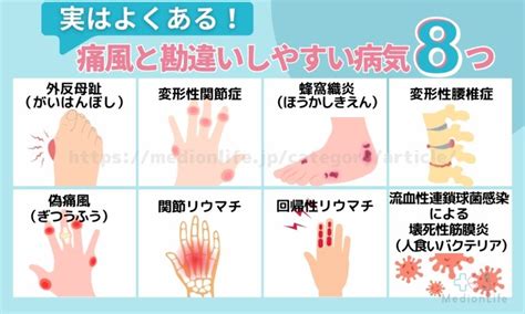 通風 女性|女性の痛風が増えている？女の痛風の症状とホルモンの関係と。